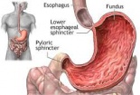 Bị đau dạ dày nên dùng loại thuốc nào?
